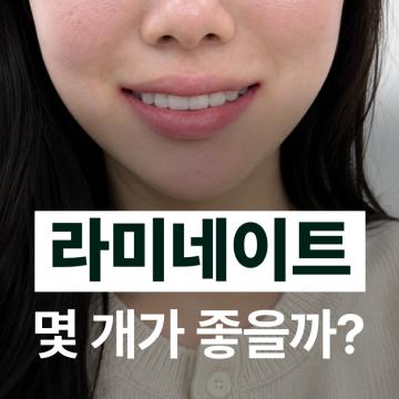 -라미네이트 몇 개가 좋을까? 1개부터도 시술 가능