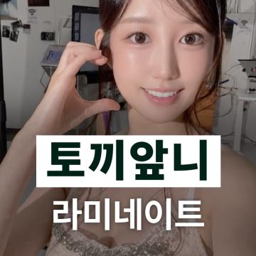 -앞니 2개만 시술 가능한 오브제